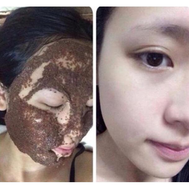 [Loại 1] Hạt Ngũ Hoa Thiên Nhiên Handmade - Hút Mủ Mụn + Dưỡng Trắng | BigBuy360 - bigbuy360.vn