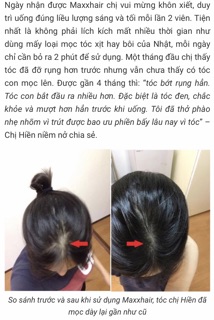 MAXXHAIR- Ngăn rụng tóc/giúp tóc mọc nhanh