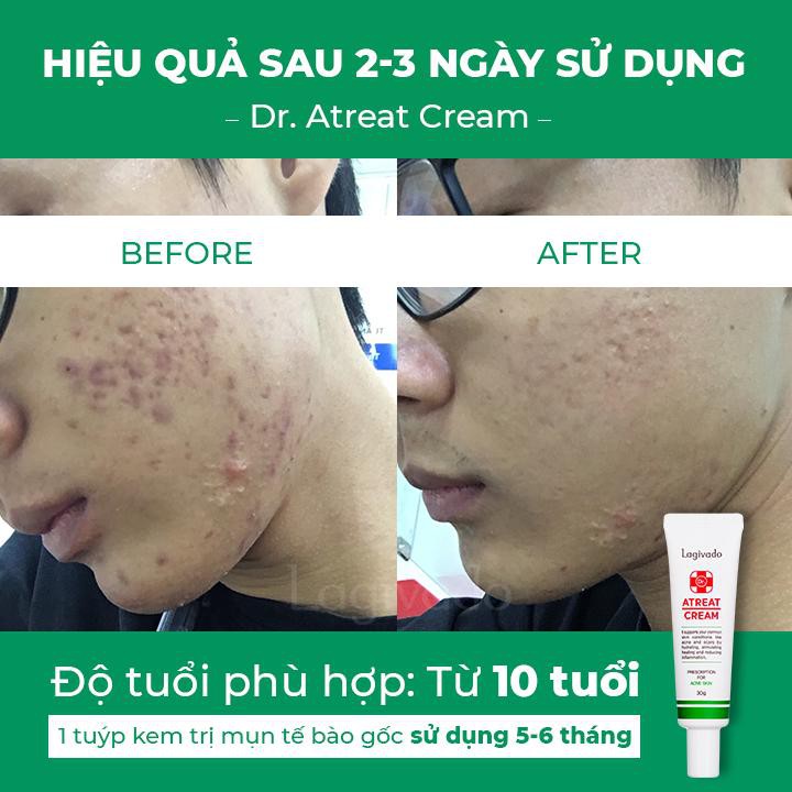 Kem chấm giảm mụn ngừa thâm sẹo rỗ, thông thoáng lỗ chân lông Dr. Atreat Cream 30g - Katta