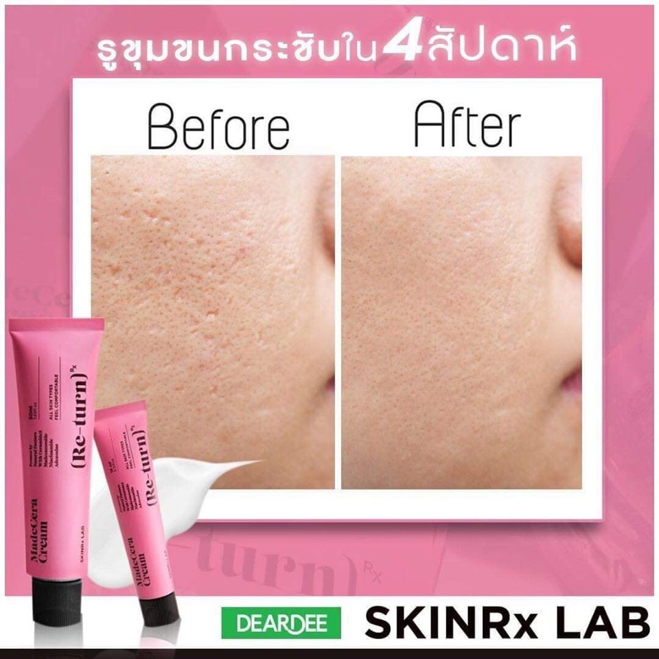 01 Tuýp Kem Dưỡng Phục Hồi Skinrx Lab Madecera Re-turn Cream 15ml