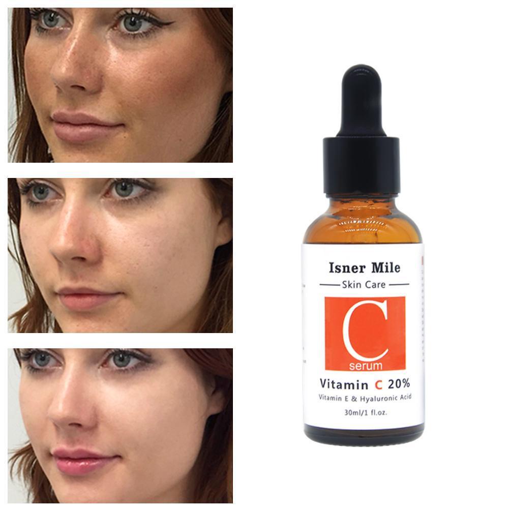 Tinh Chất Hyaluronic Acid ISNER MILEC Hyaluronic Acid Chăm Sóc Da Mặt Sodium L-vitamin Vserum I6C0