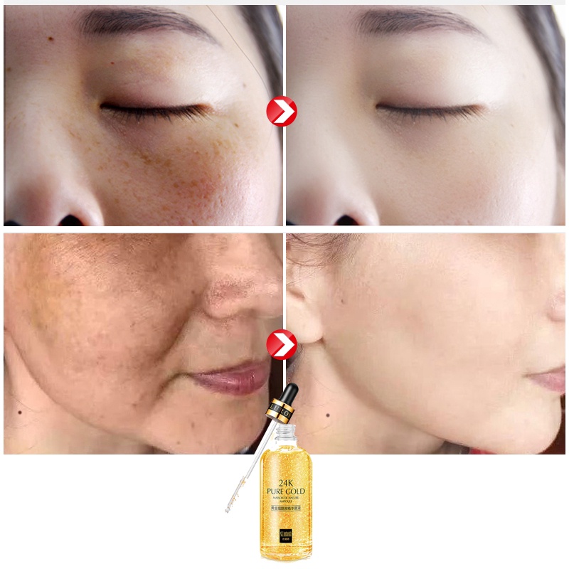Tinh chất niacinamide SENANA vàng 24K dưỡng ẩm chống nếp nhăn làm săn chắc và trắng da