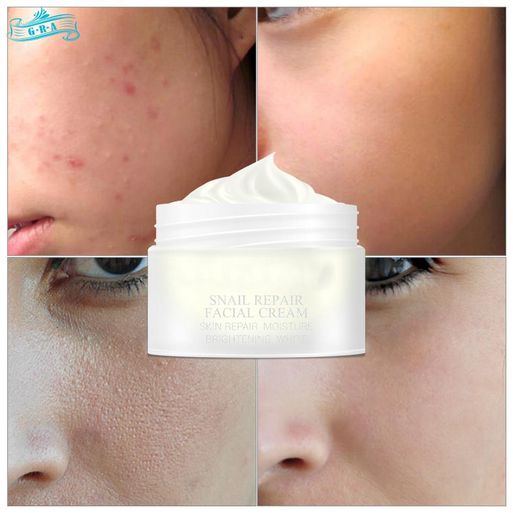 (hàng Mới Về) Tinh Chất Ốc Sên 30g Giúp Chống Lão Hóa Cao Cấp | BigBuy360 - bigbuy360.vn