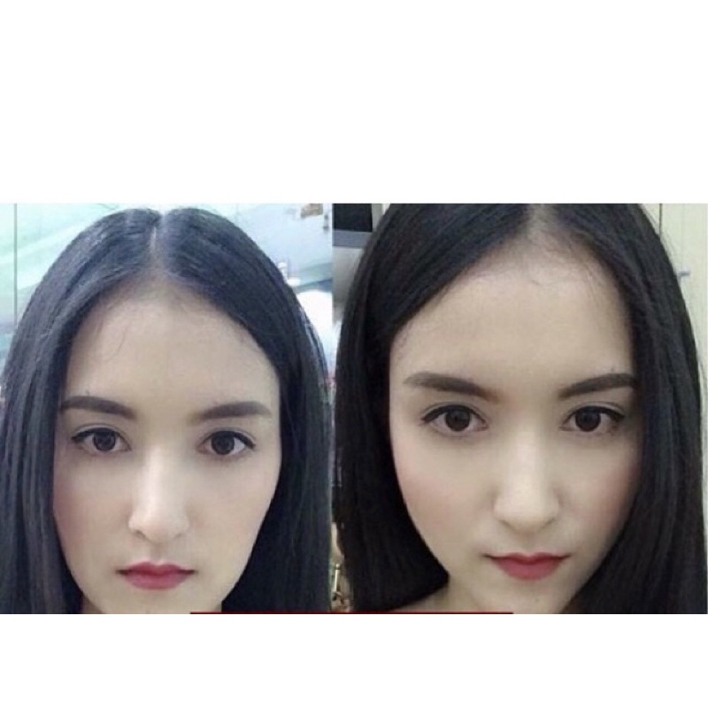 Tinh chất Mircale Pháp làm đầy má, tạo má baby chỉ sau 1 tháng