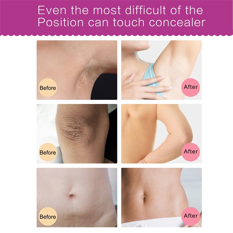 [Hàng mới về] Kem dưỡng trắng da vùng dưới cánh tay / khuỷu tay / đầu gối / vùng bikini