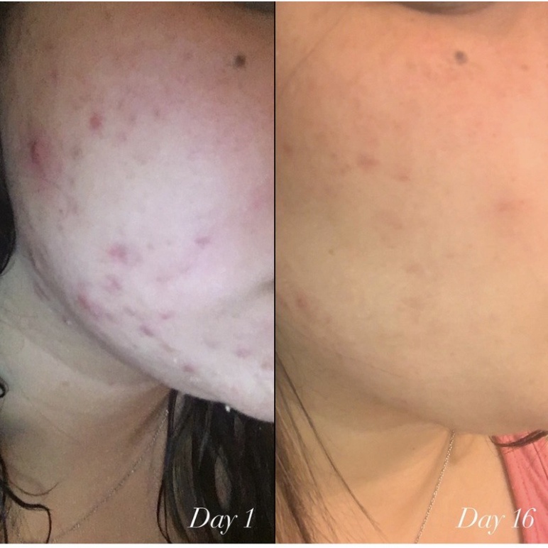 Tinh chất Serum Shani Darden Retinol Reform 1ml