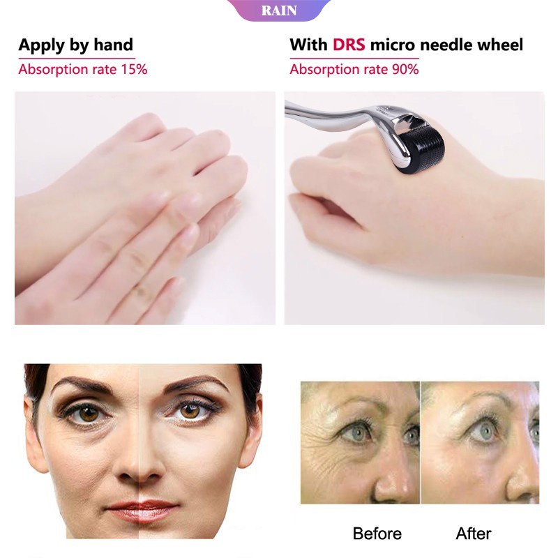 Cây Lăn Kim 540 Micro Chuyên Dụng Kích Thích Mọc Râu/Tóc 0.25/0.5mm