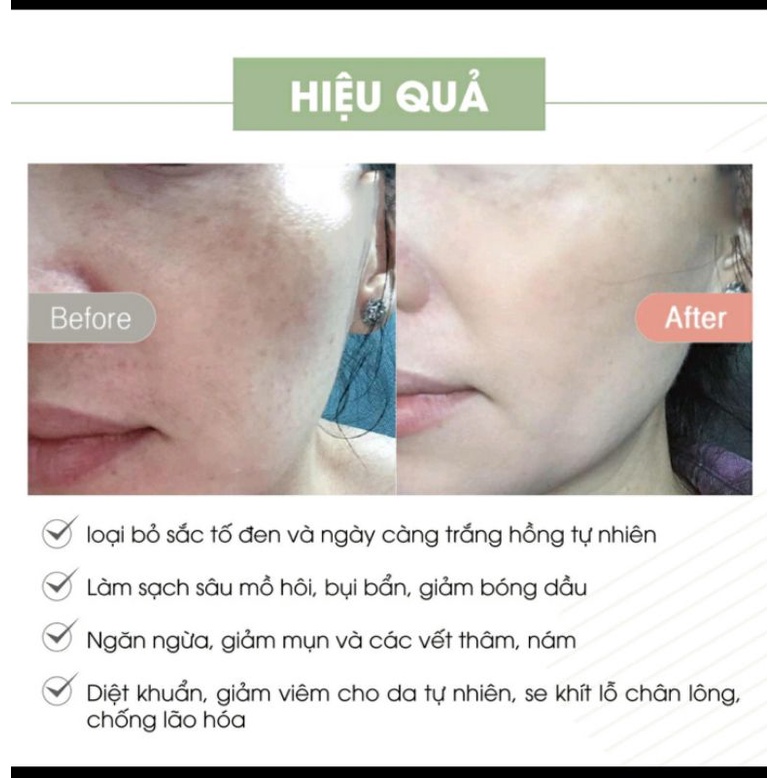 Kem face pháp A cosmetics date mới 2023