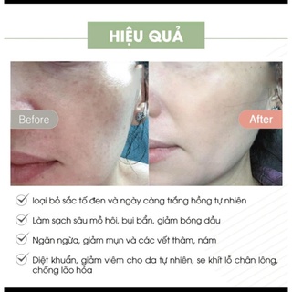 Kem face Pháp A cosmetics mẫu mới - 50g