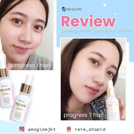 (Hàng Mới Về) Serum Dưỡng Da Mặt Today "Ms Glow Peel