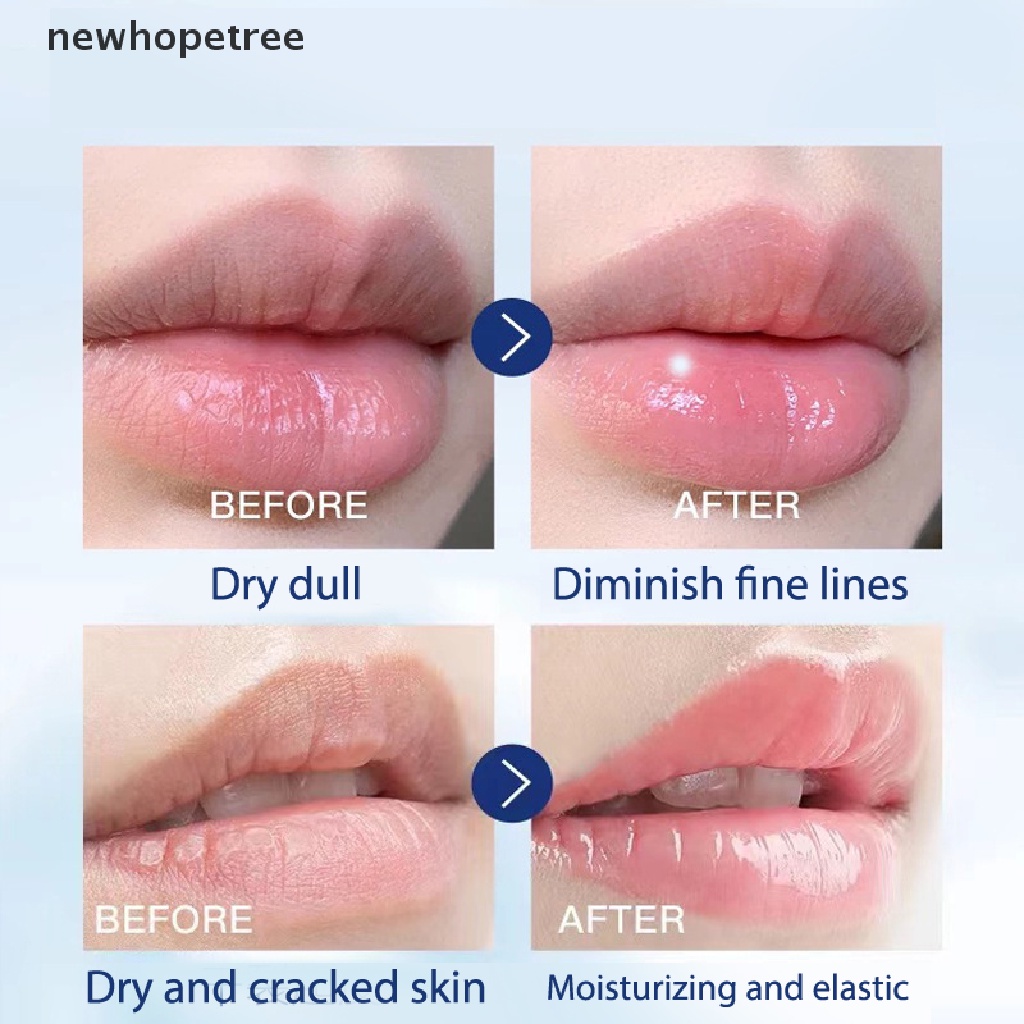 [Hàng mới về] Son dưỡng môi Vaseline giữ ẩm chống nứt nẻ