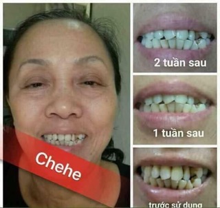 Bột trắng răng CHEHE