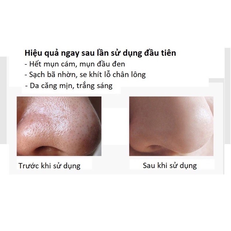 BỘT LỘT MỤN THAN TRE - TRÀ XANH (LỘT MỤN ĐẦU ĐEN, MỤN CÁM, SẠCH BÃ NHỜN-BỤI BẨN -AN TOÀN CHO DA)