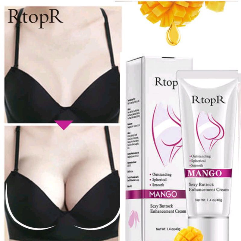 Kem Nở Mông Xóa Thâm Cao Cấp | BigBuy360 - bigbuy360.vn