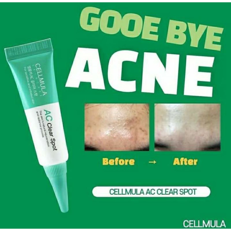 Kem chấm mụn AC Claer Spot 10ml