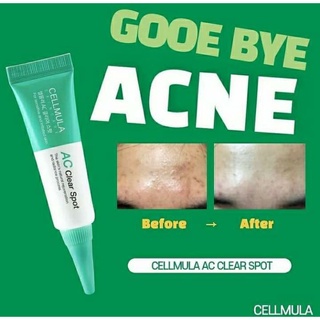 Kem chấm mụn AC Claer Spot 10ml