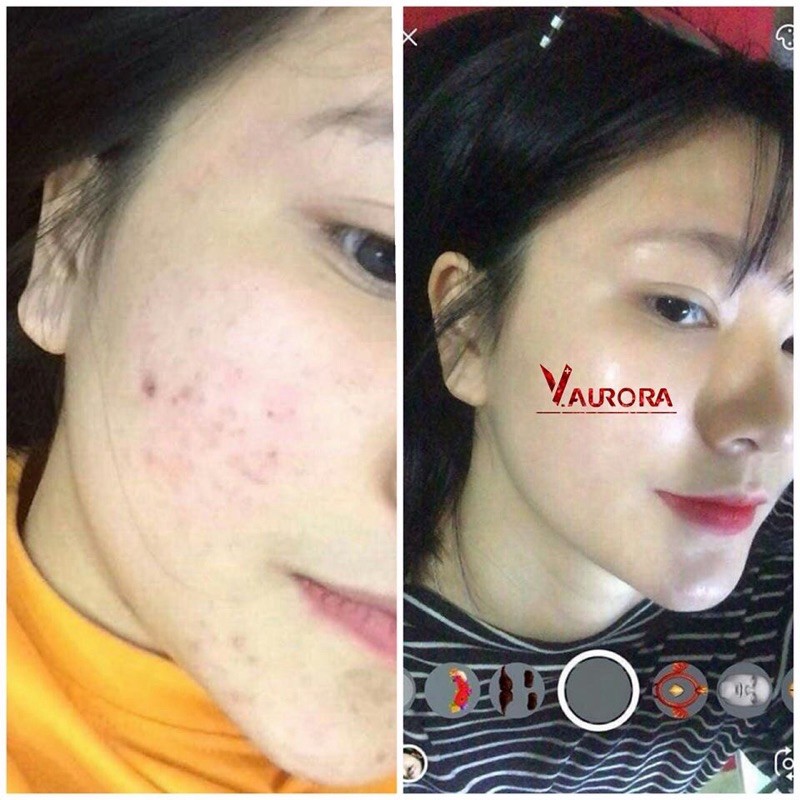 Combo dưỡng phục hồi | BigBuy360 - bigbuy360.vn