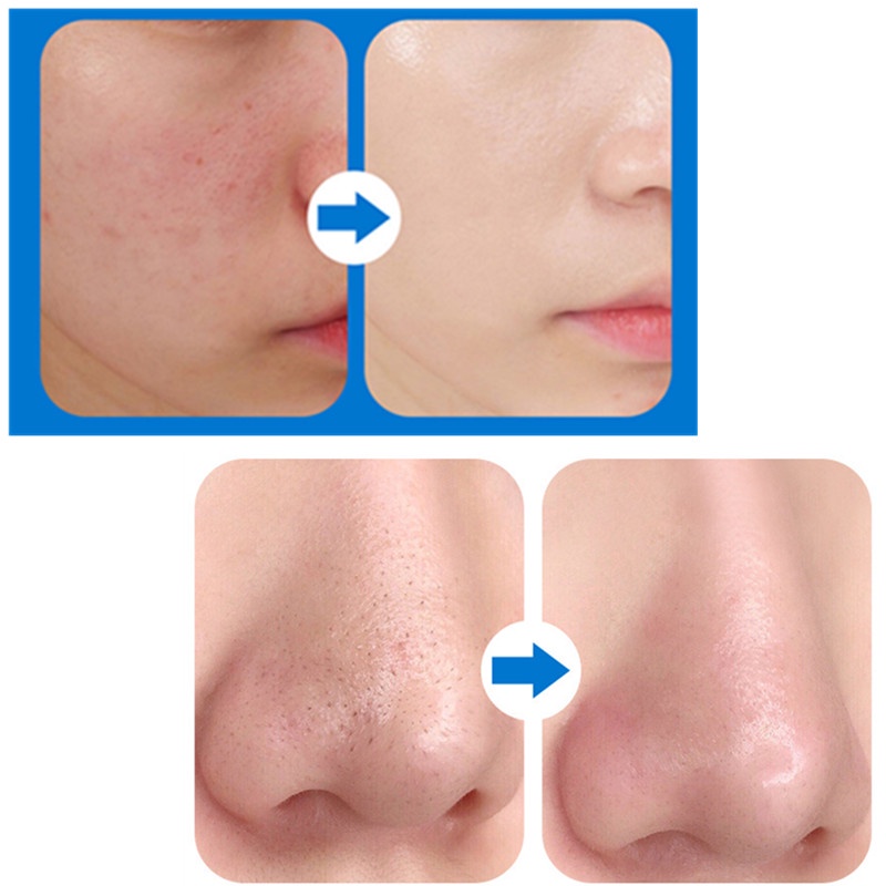 1 hũ mặt nạ CAPPUVINI® NOVO làm sạch sâu dưỡng ẩm làm trắng da