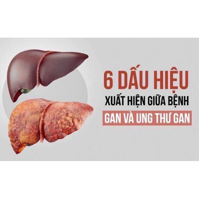 Bổ gan Kwangdong LiverX10 hộp 120 viên Hàn Quốc HÀNG NỘI ĐỊA HÀN QUỐC NHẬP KHẢU 100% | BigBuy360 - bigbuy360.vn