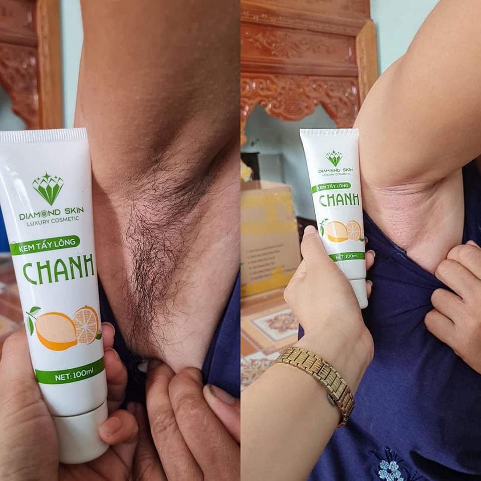 Combo Kem Tẩy Lông Chanh Gấc Triệt Lông Tại Nhà Hiệu Quả Không Mọc Lại | BigBuy360 - bigbuy360.vn