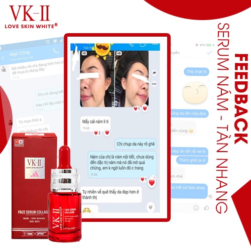 Tinh chất dưỡng da mờ nám, tàn nhang, đồi mồi VK-II Love Skin White Face Serum Collagen 15ml