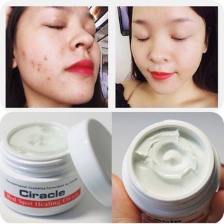 Kem giảm mụn Ciracle Red Spot Cream