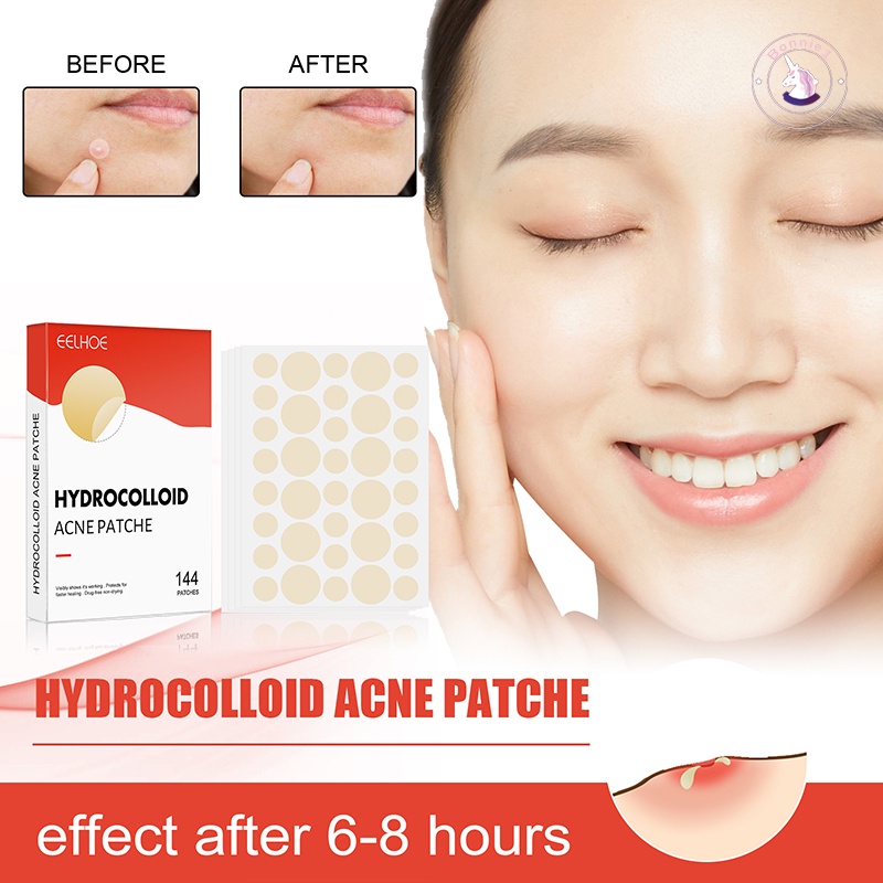 Miếng Dán Hấp Thụ Hydrocolloid Chăm Sóc Da Mặt Vô Hình
