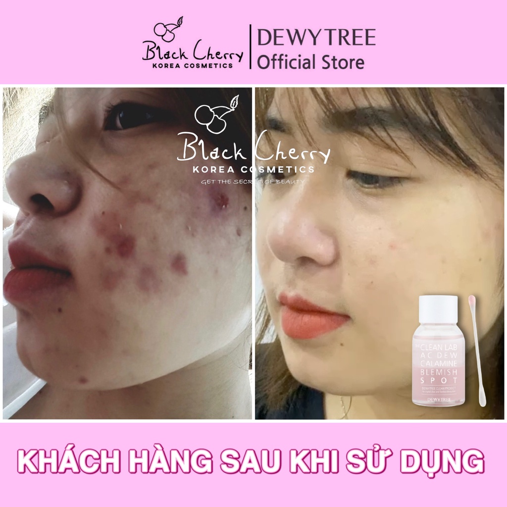 Chấm mụn Dewytree The Clean Lab AC DEW Calamine Blemish Spot 20ml