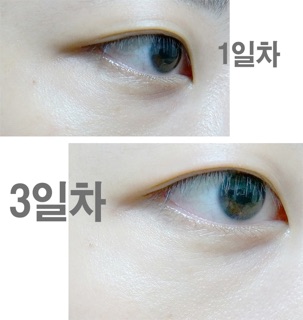 SERUM BORTOX MEDIPEEL HÀN QUỐC