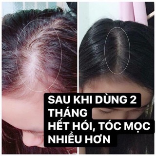 Tinh dầu bưởi trị rụng