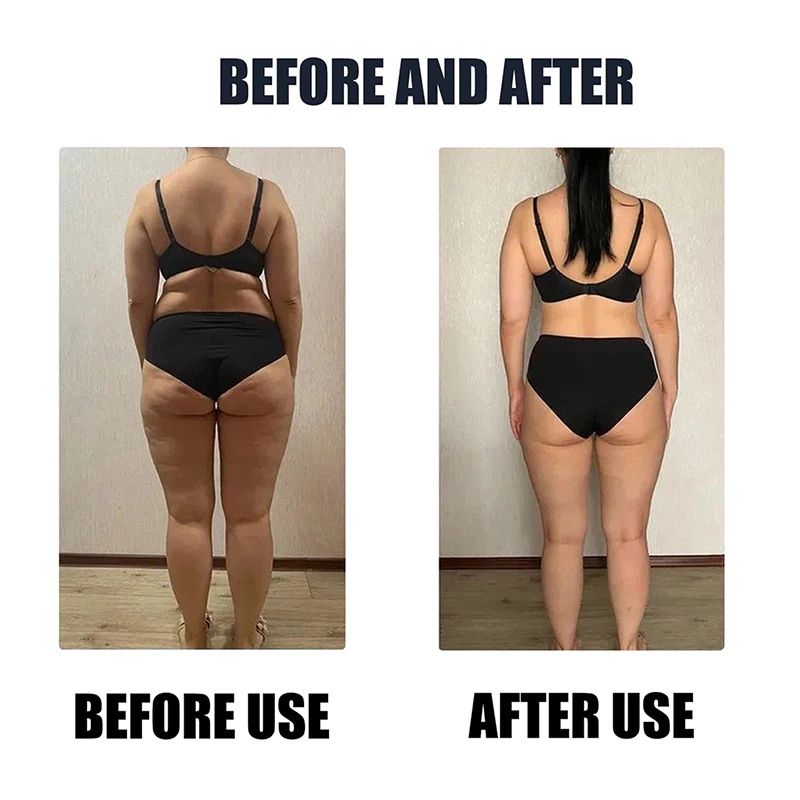 Set 30 Miếng Dán Tan Mỡ Bụng Giảm Cân Phong Cách Trung Hoa