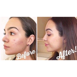 Serum Balance