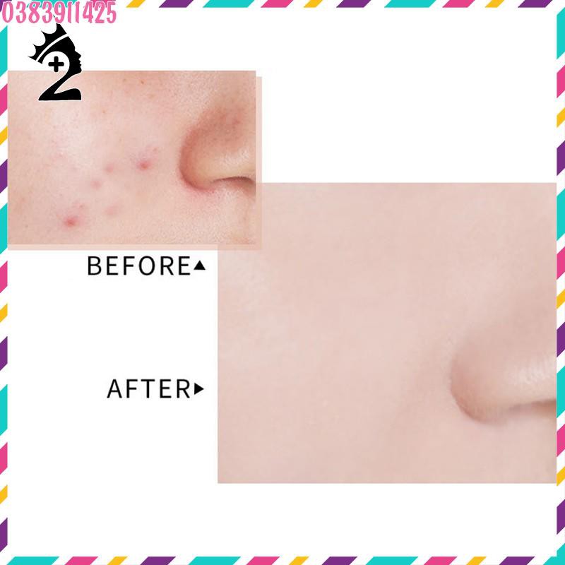 Kem nền che khuyết WodWod Perfect Beauty Concealer TPP | BigBuy360 - bigbuy360.vn