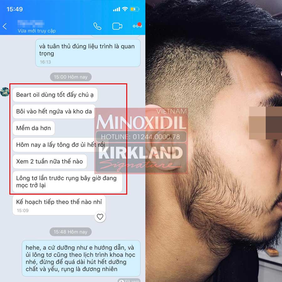 Dầu dưỡng râu Beard oil