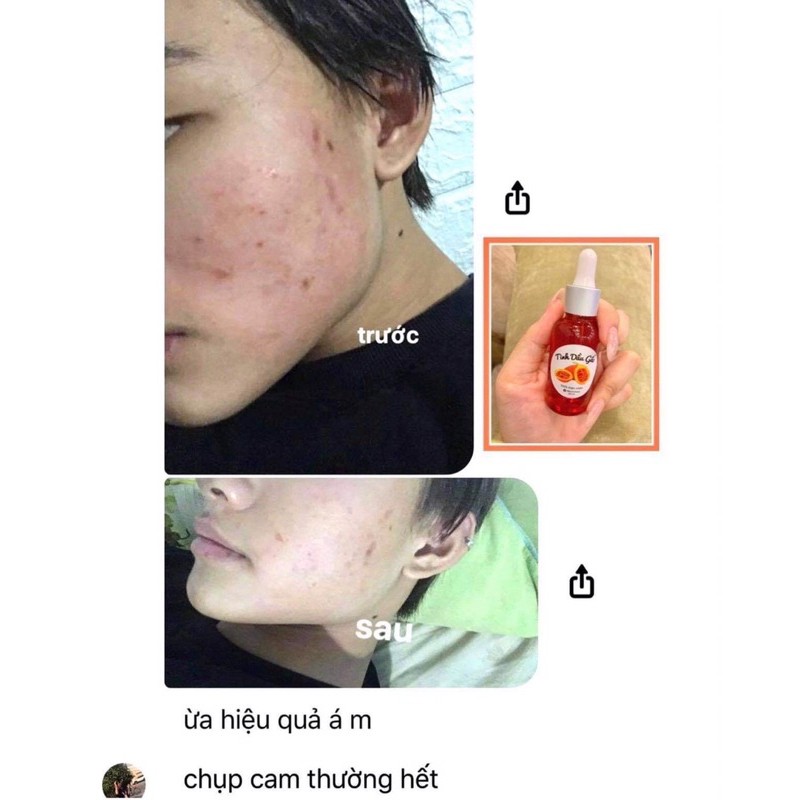 Tinh Dầu Gấc Tái Tạo Da | BigBuy360 - bigbuy360.vn