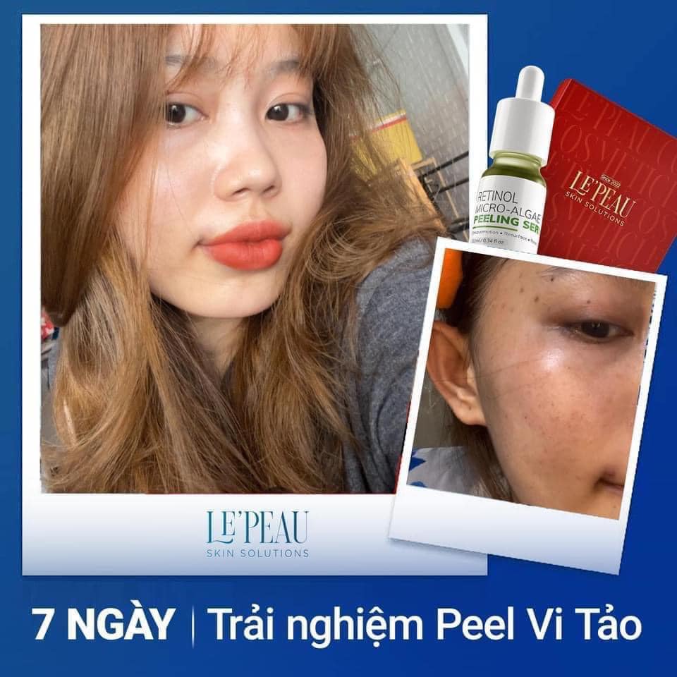 Peel Da Retinol Vi Tảo Le'Peau - Tinh Chất Peel Da Sinh Học