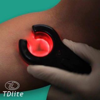 Máy dò tĩnh mạch -Giúp tìm tĩnh mạnh nhanh, dễ dàng