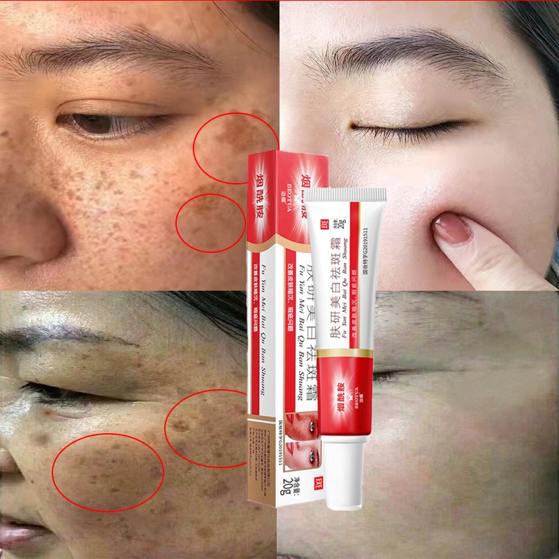 Kem Dưỡng Trắng Da Mặt Hỗ trợ giảm nám/ Đốm Đen