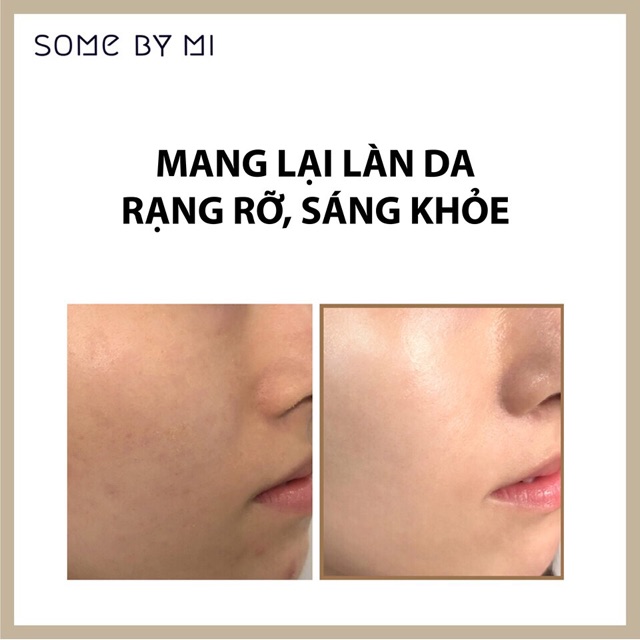 [Chính Hãng] Combo Toner + Serum Dưỡng Trắng Vitamin C Some By Mi Galactomyces Pure [200ml + 30ml] | BigBuy360 - bigbuy360.vn