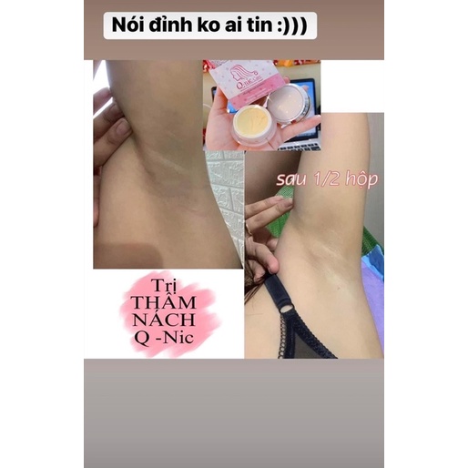 Kem giúp giảm Thâm Nách, Thâm Mông, Thâm vùng Bikini Qnic Loại To