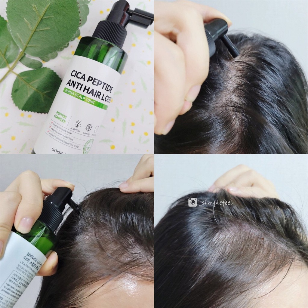 Xịt dưỡng tóc ngăn ngừa rụng tóc Some By Mi Cica Peptide Anti Hair Loss Derma Scalp Tonic 150ml