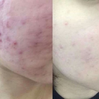 Toner BINGASUI MEISHOKU Nhật Bản
