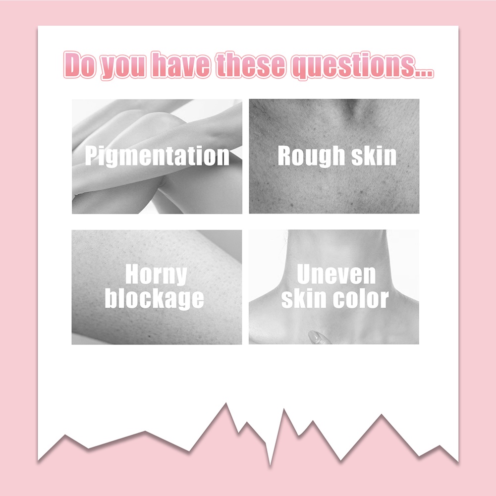 Eelhoe đào Niacinamide cơ thể chà Kem làm sạch sâu da đi cutin da chết điều trị mụn trứng cá dưỡng ẩm-ampere