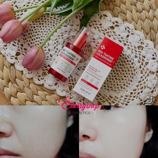 Tinh chất dưỡng SOMEBYMI Red Tea Tree Cicassoside Final Solution Serum