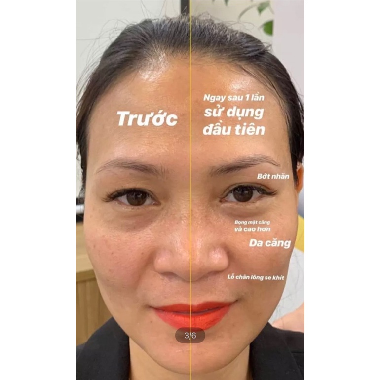 [DATE 05/22] Tinh chất vàng 24k Protein Peptide và chỉ căng cơ Protein Nano SARADOR GOLD PROTEIN PEPTIDE (Nhât)