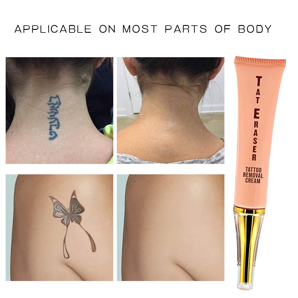 Kem xóa hình xăm vĩnh viễn tự nhiên không gây đau