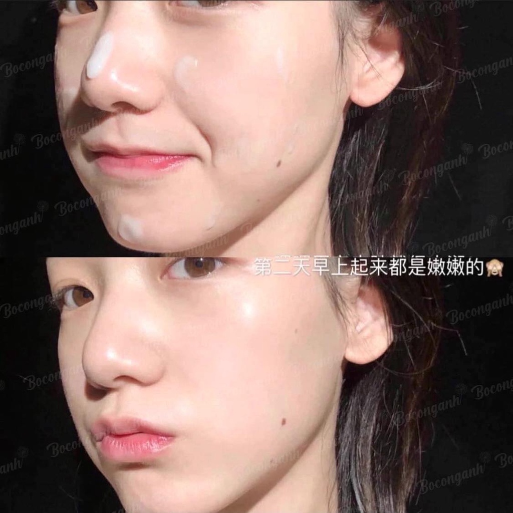 KEM DƯỠNG ẨM KIỀM DẦU, ĐIỀU TIẾT NHỜN FLOSLEK ANTI ACNE MATTIFYING 50ML
