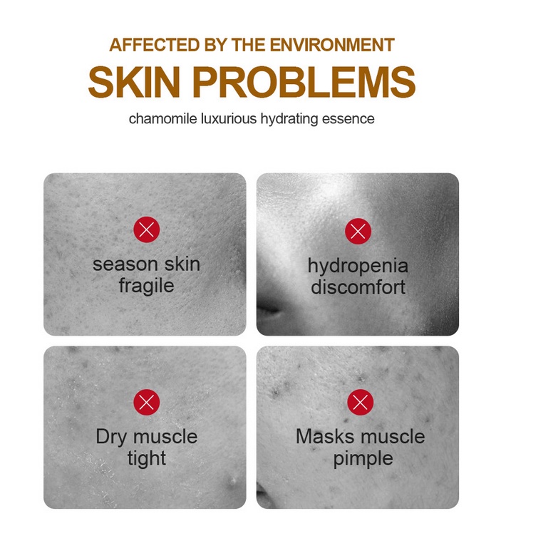 Tinh Chất Chiết Xuất Hoa Hồng / Lô Hội / Hoa Cúc / Hoa Cúc Dưỡng Ẩm Làm Sáng Da Khô 30ml