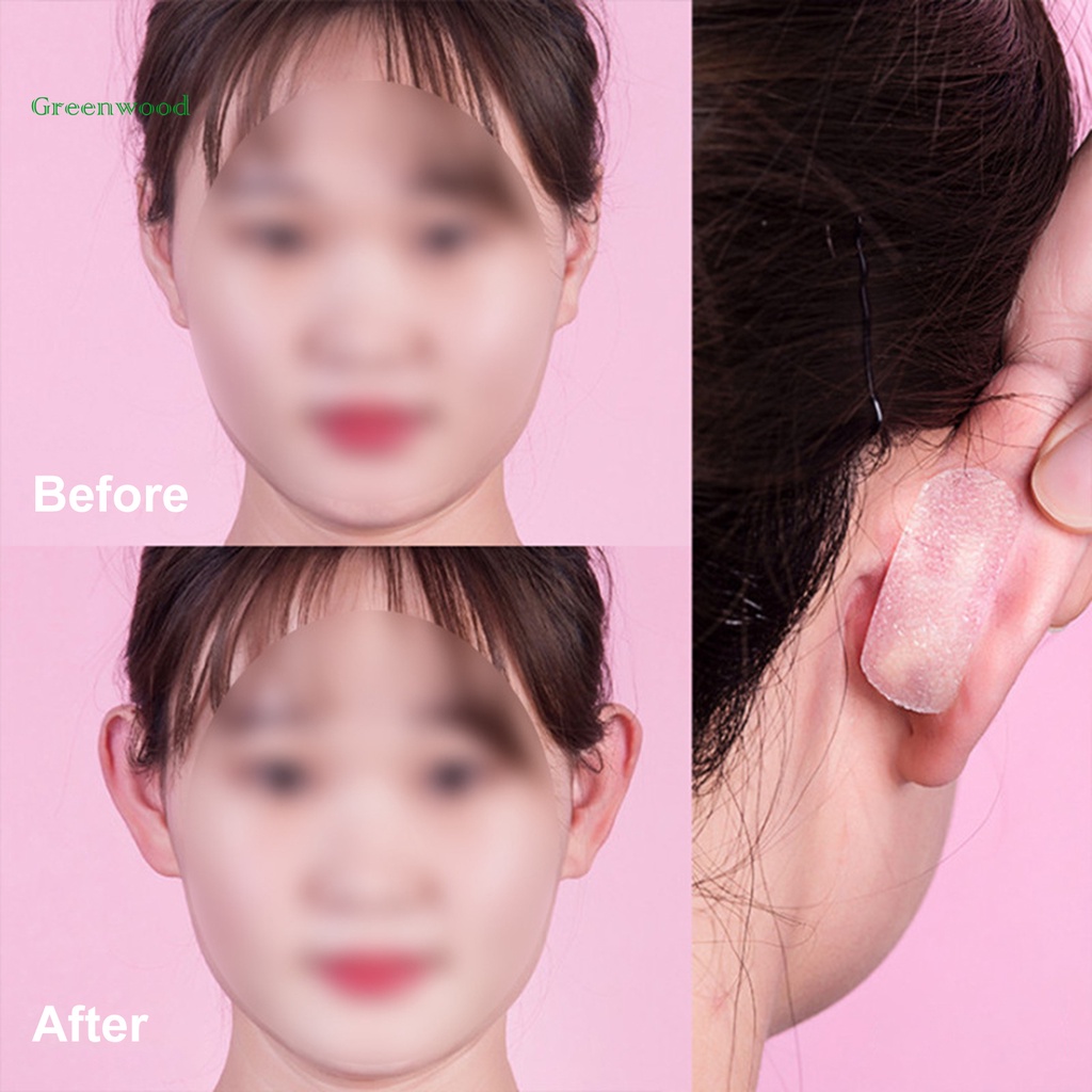 Miếng dán chỉnh sửa dáng tai không gây kích ứng lâu trôi dành cho nữ