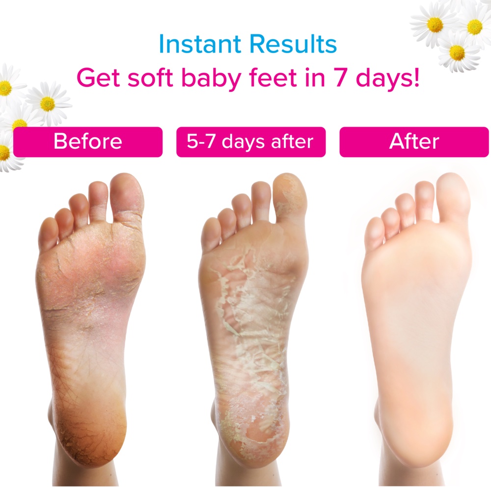 Tẩy Tế Bào Chết Chân, Khuỷu Tay, Đầu Gối Dạng Xịt Foot Peeling Spray Orange Oil